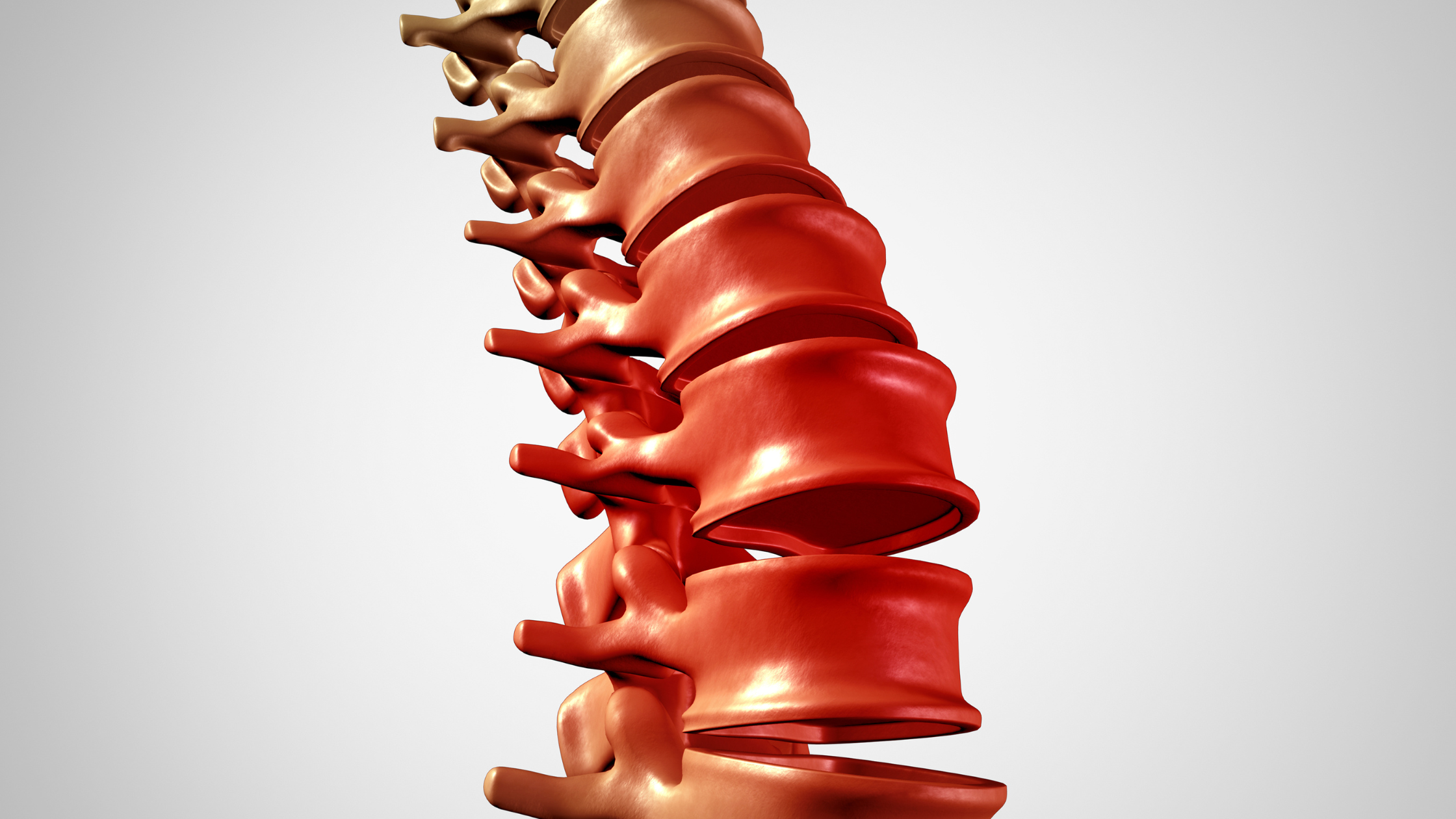 facet joint syndrome